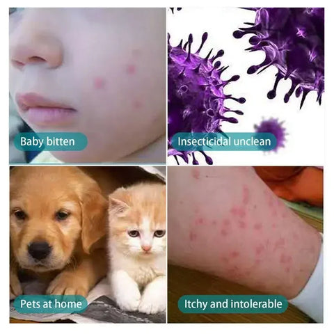 Anti-Itch Spray